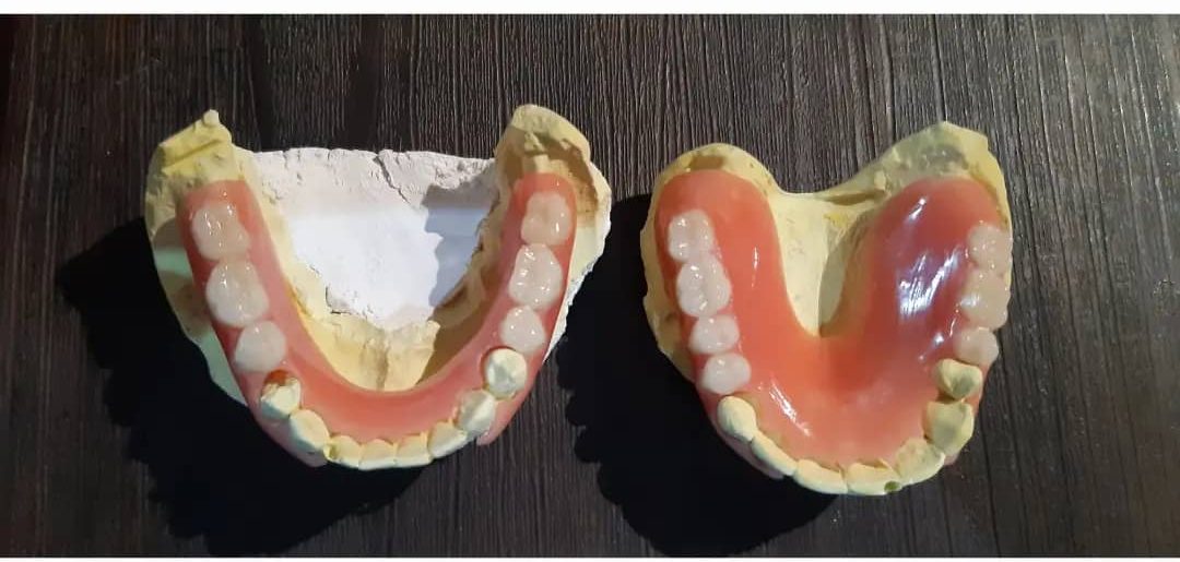 ساخت دندان مصنوعی